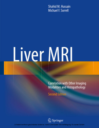 Liver MRI
