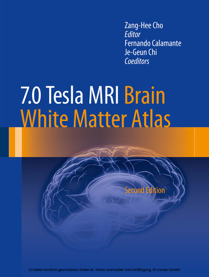 7.0 Tesla MRI Brain White Matter Atlas main product photo