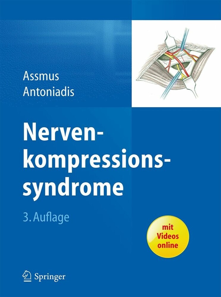 Nervenkompressionssyndrome main product photo