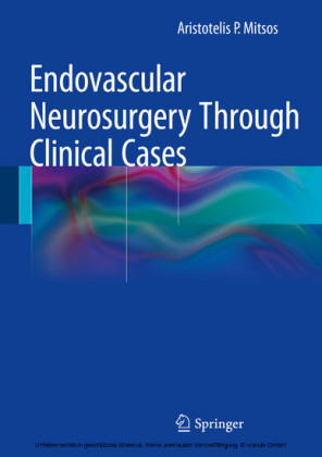Endovascular Neurosurgery Through Clinical Cases