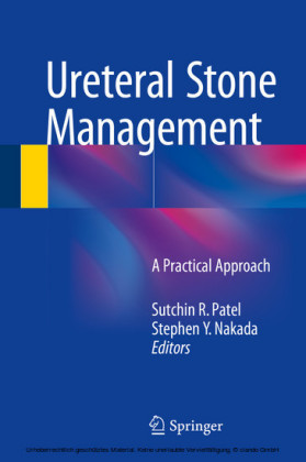 Ureteral Stone Management