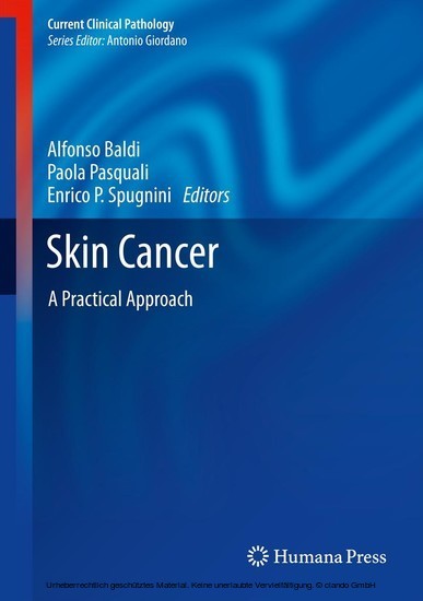 Skin Cancer main product photo