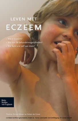 Leven met eczeem