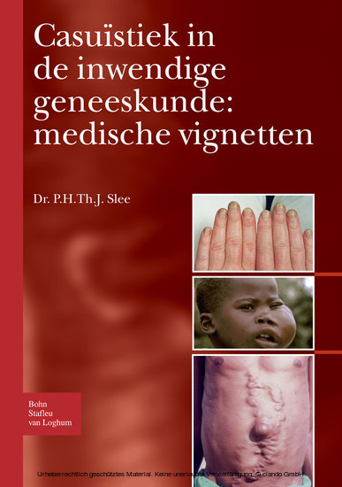Casuïstiek in de inwendige geneeskunde: medische vignetten main product photo