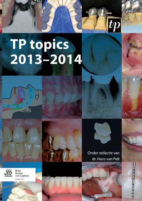 TP topics 2013-2014 main product photo