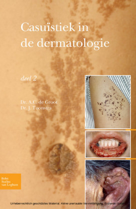 Casuïstiek in de dermatologie - deel 2