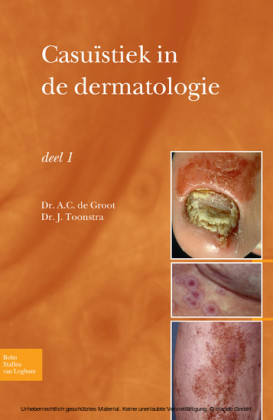 Casuïstiek in de dermatologie - deel I