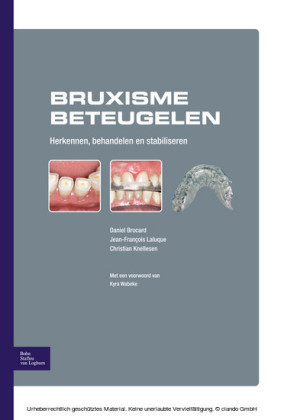 Bruxisme beteugelen