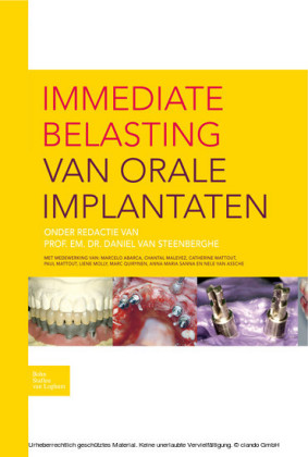 Immediate belasting van orale implantaten