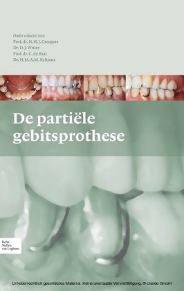 De partiële gebitsprothese