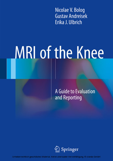 MRI of the Knee main product photo
