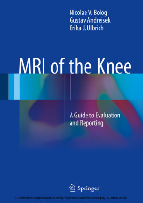 MRI of the Knee