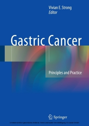 Gastric Cancer