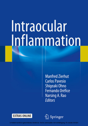 Intraocular Inflammation