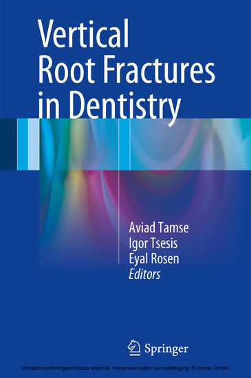 Vertical Root Fractures in Dentistry main product photo
