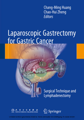 Laparoscopic Gastrectomy for Gastric Cancer