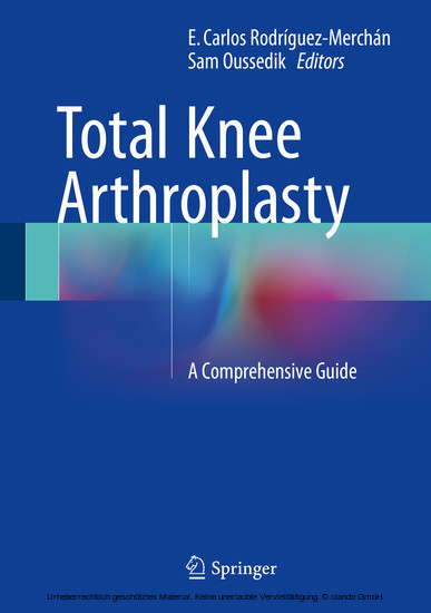 Total Knee Arthroplasty main product photo