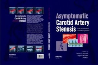 Asymptomatic Carotid Artery Stenosis