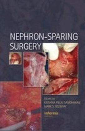 Nephron-Sparing Surgery main product photo