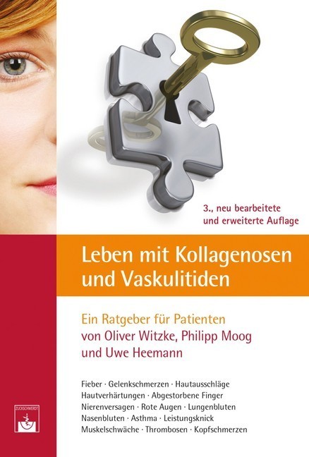 Leben mit Kollagenosen und Vaskulitiden main product photo