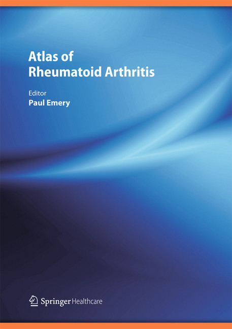 Atlas of Rheumatoid Arthritis main product photo