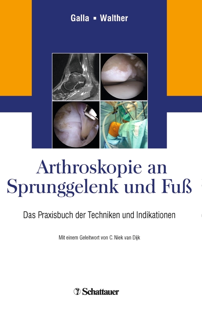Arthroskopie an Sprunggelenk und Fuß main product photo
