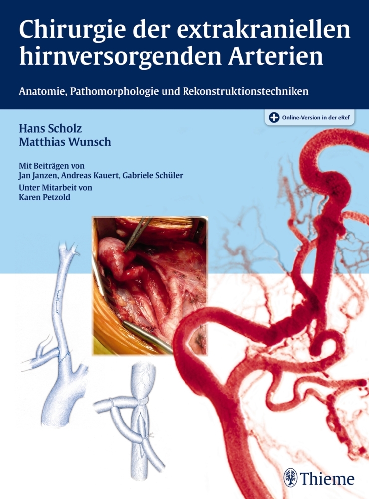 Chirurgie der extrakraniellen hirnversorgenden Arterien main product photo