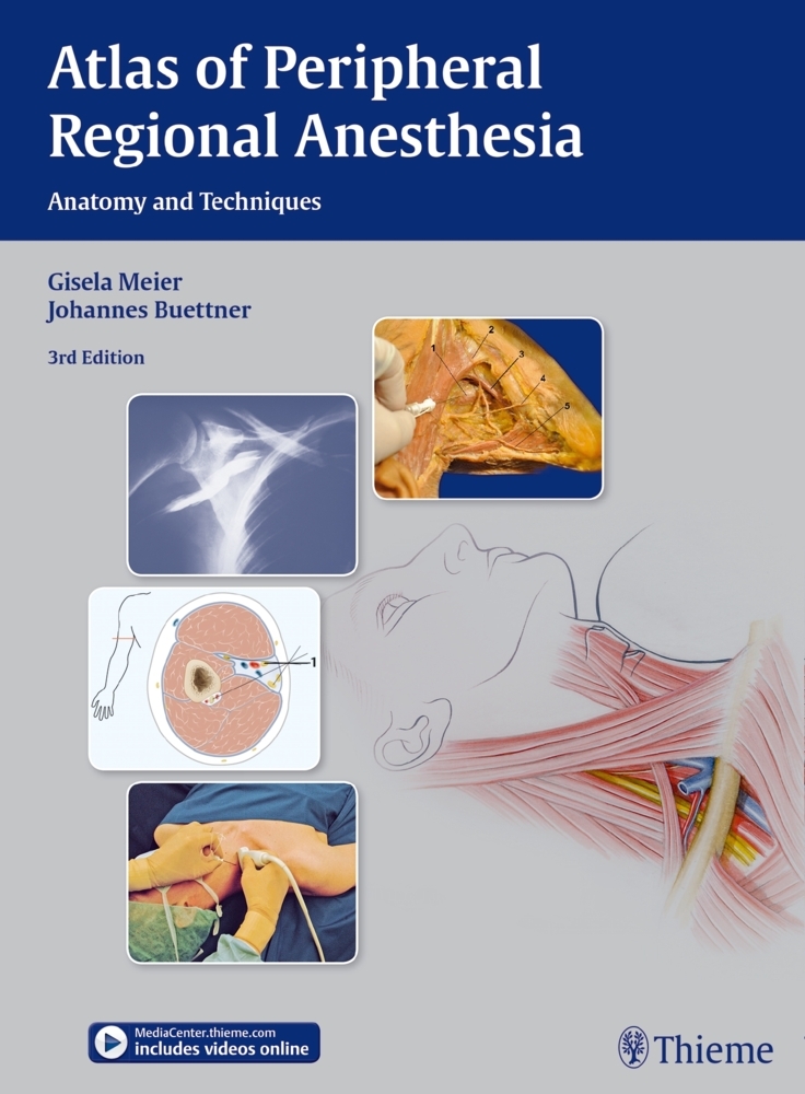 Atlas of Peripheral Regional Anesthesia main product photo