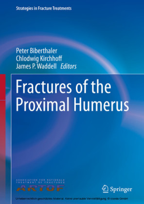 Fractures of the Proximal Humerus