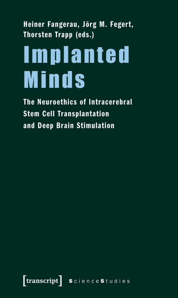 Implanted Minds main product photo