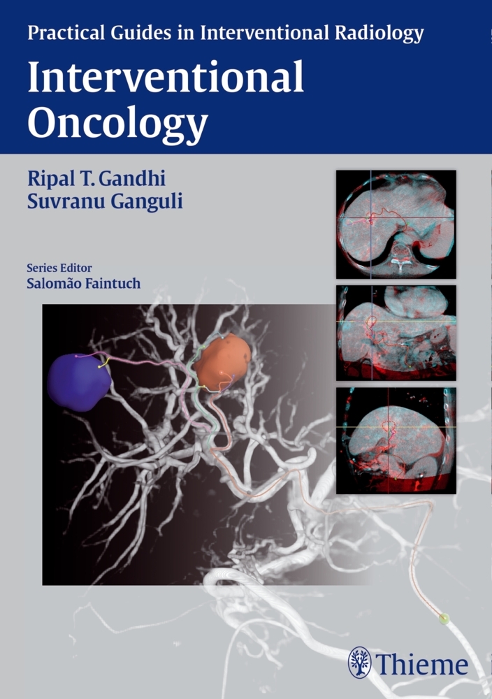 Interventional Oncology main product photo