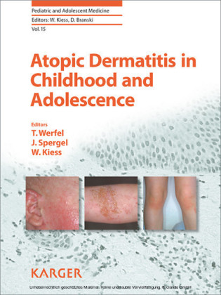 Atopic Dermatitis in Childhood and Adolescence