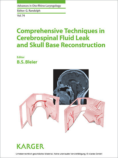 Comprehensive Techniques in CSF Leak Repair and Skull Base Reconstruction main product photo