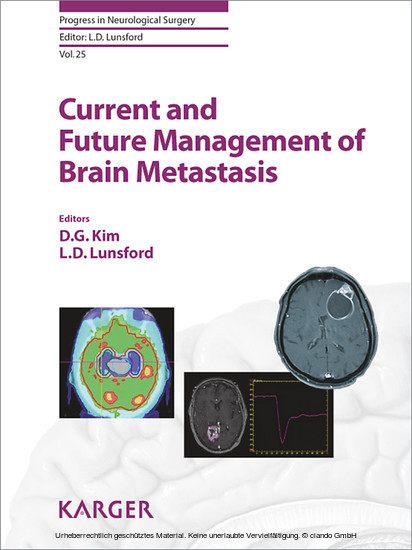 Current and Future Management of Brain Metastasis main product photo