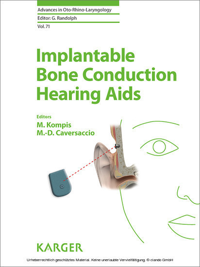 Implantable Bone Conduction Hearing Aids main product photo