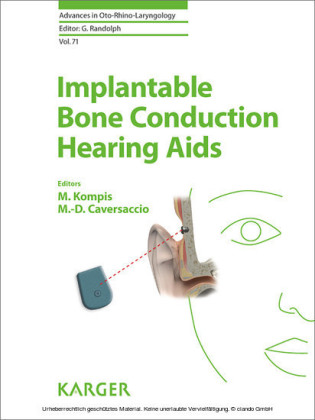 Implantable Bone Conduction Hearing Aids