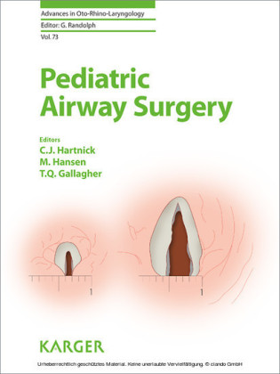 Pediatric Airway Surgery
