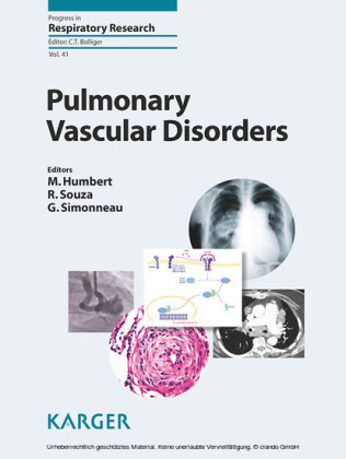 Pulmonary Vascular Disorders