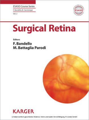 Surgical Retina