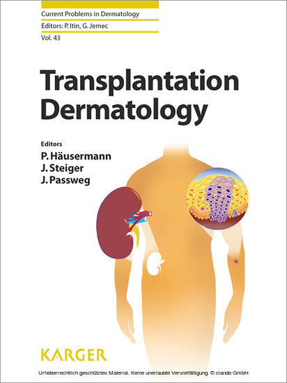 Transplantation Dermatology main product photo