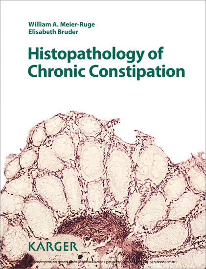 Histopathology of Chronic Constipation main product photo