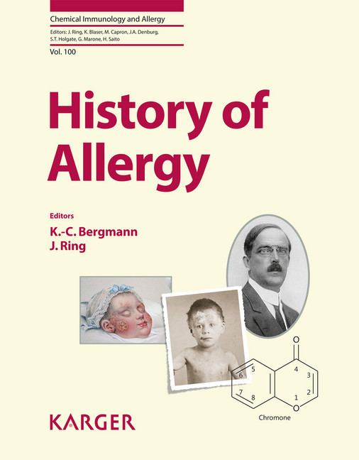 History of Allergy main product photo