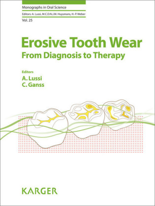 Erosive Tooth Wear