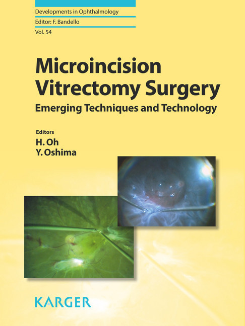 Microincision Vitrectomy Surgery main product photo