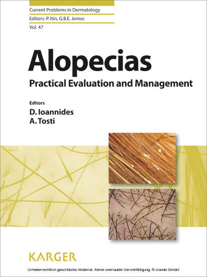 Alopecias - Practical Evaluation and Management main product photo