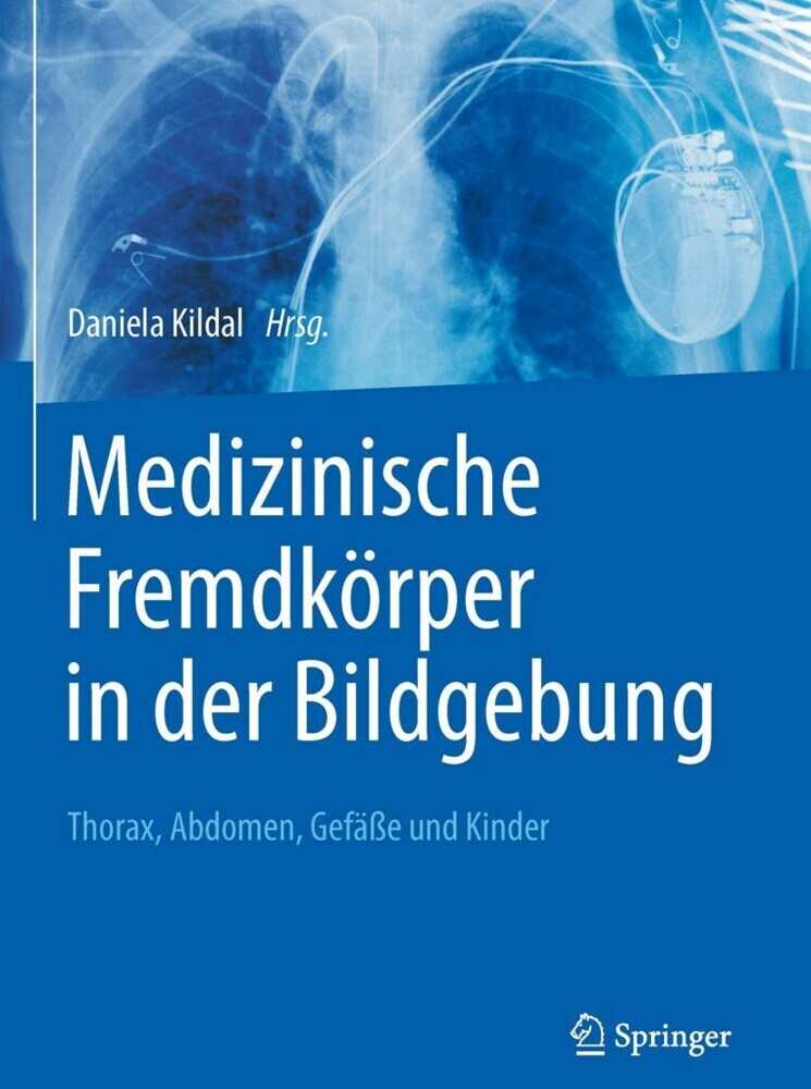 Medizinische Fremdkörper in der Bildgebung main product photo