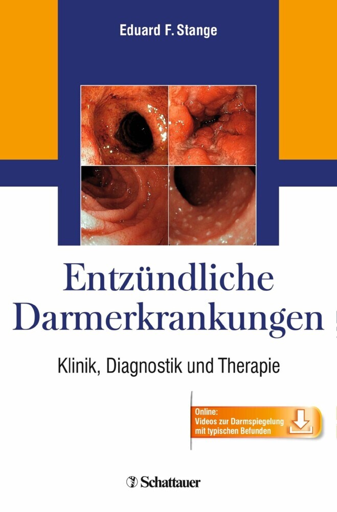 Entzündliche Darmerkrankungen main product photo