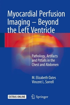 Myocardial Perfusion Imaging - Beyond the Left Ventricle