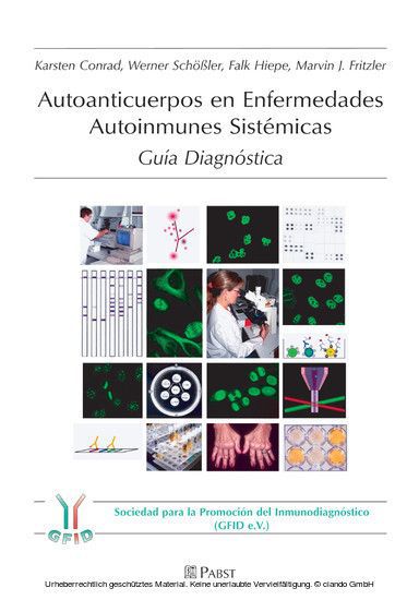 Autoanticuerpos en Enfermedades Autoinmunes Sistémicas main product photo