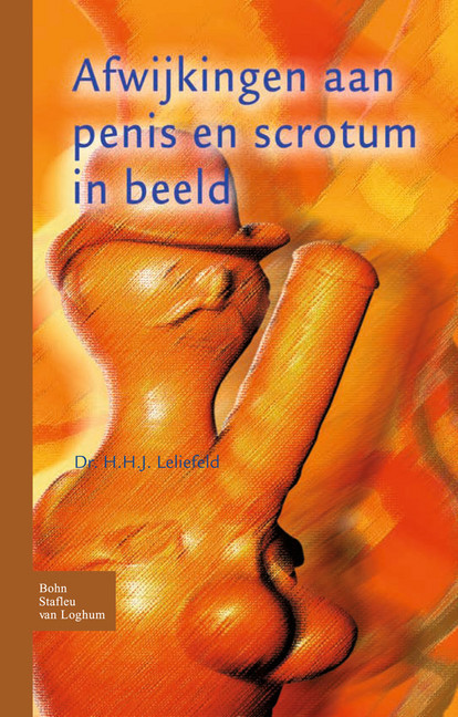 Afwijkingen aan penis en scrotum in beeld main product photo